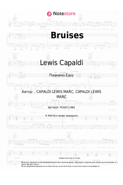 undefined Lewis Capaldi - Bruises